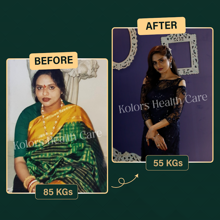 Madhubala before and after weight loss: 85 kgs to 55 kgs