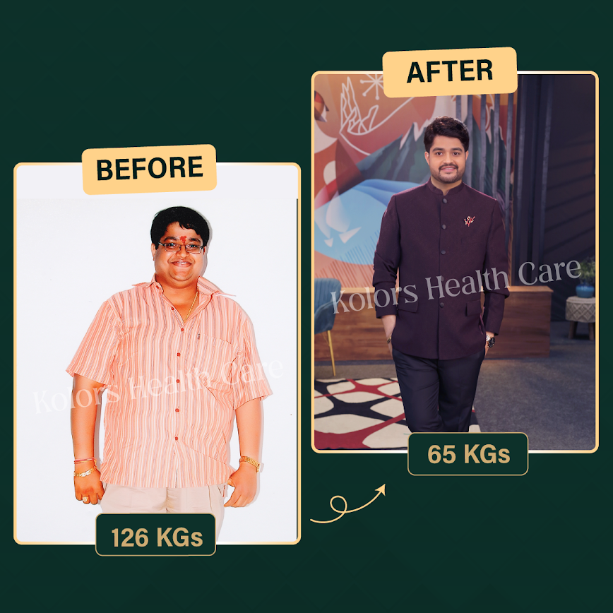 MD Sir before and after weight loss: 126 kgs to 65 kgs